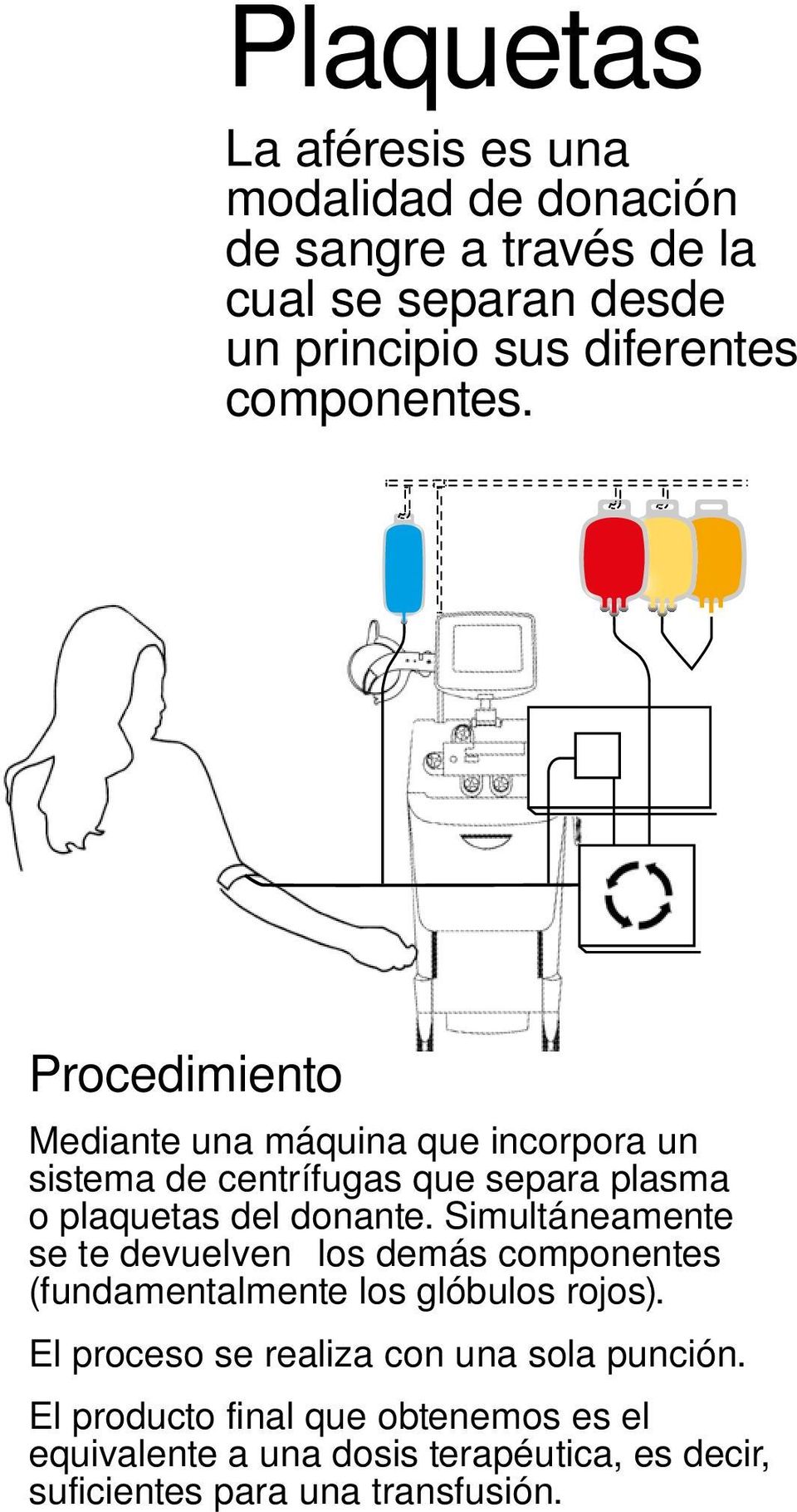 Procedimiento Mediante una máquina que incorpora un sistema de centrífugas que separa plasma o plaquetas del donante.