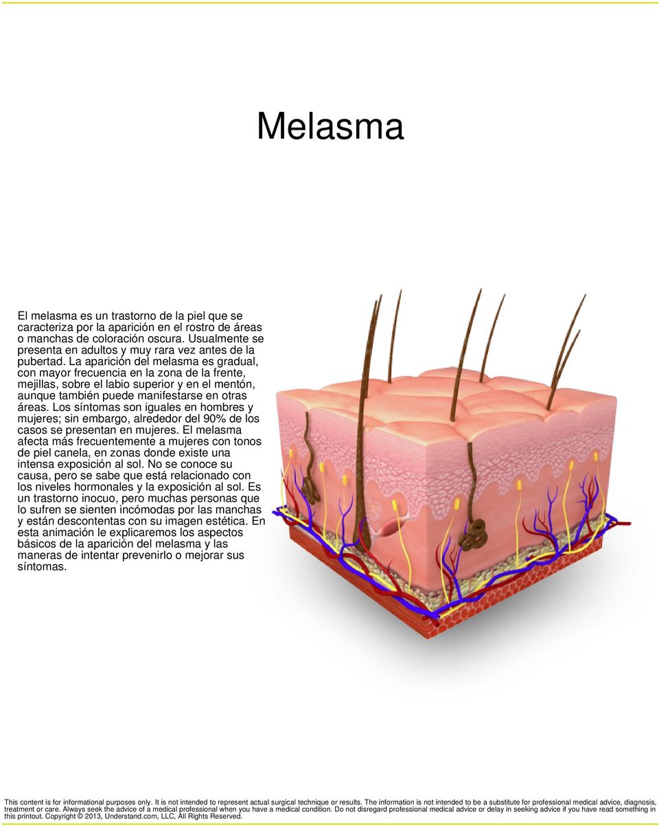 La aparición del melasma es gradual, con mayor frecuencia en la zona de la frente, mejillas, sobre el labio superior y en el mentón, aunque también puede manifestarse en otras áreas.