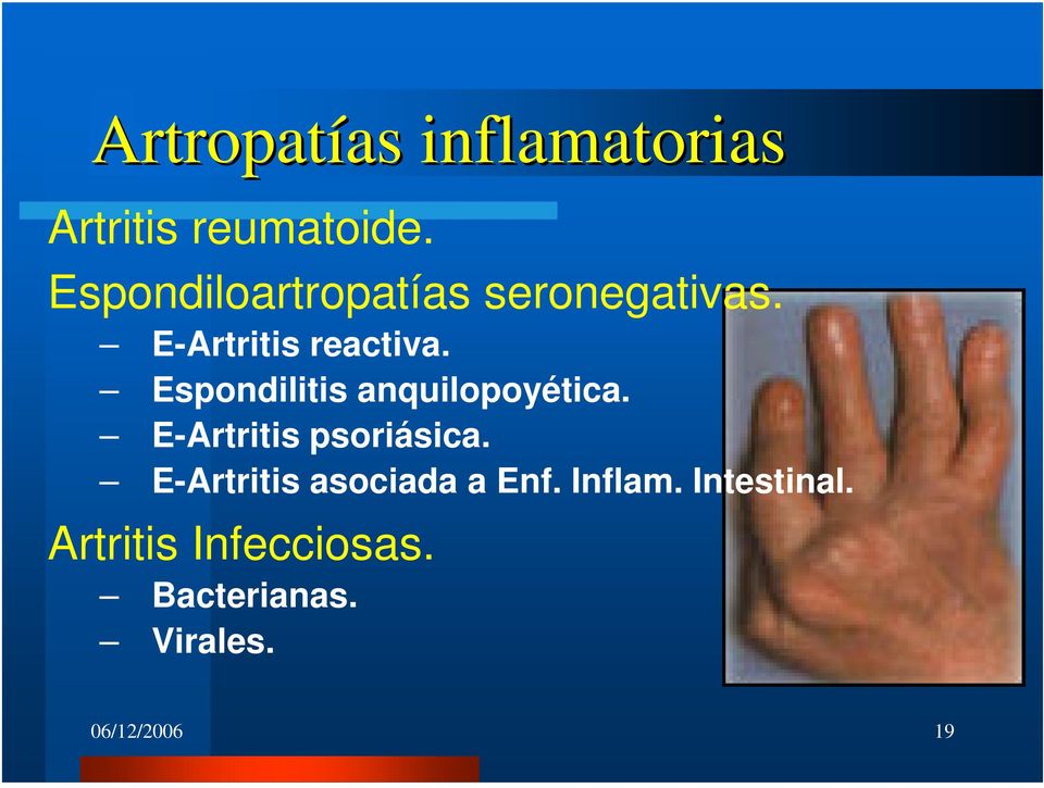 Espondilitis anquilopoyética. E-Artritis psoriásica.