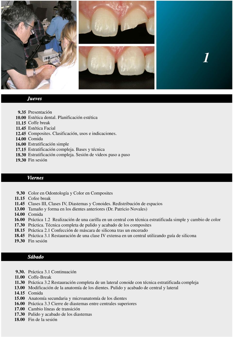 30 Color en Odontología y Color en Composites Cofee break Clases III, Clases IV, Diastemas y Conoides. Redistribución de espacios Tamaño y forma en los dientes anteriores (Dr.