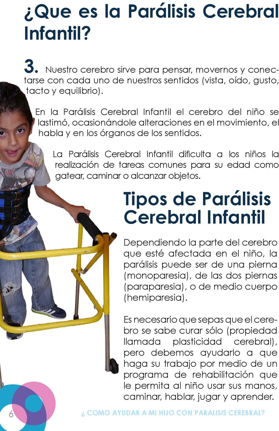 La Parálisis Cerebral Infantil dificulta a los niños la realización de tareas comunes para su edad como gatear, caminar o alcanzar objetos.
