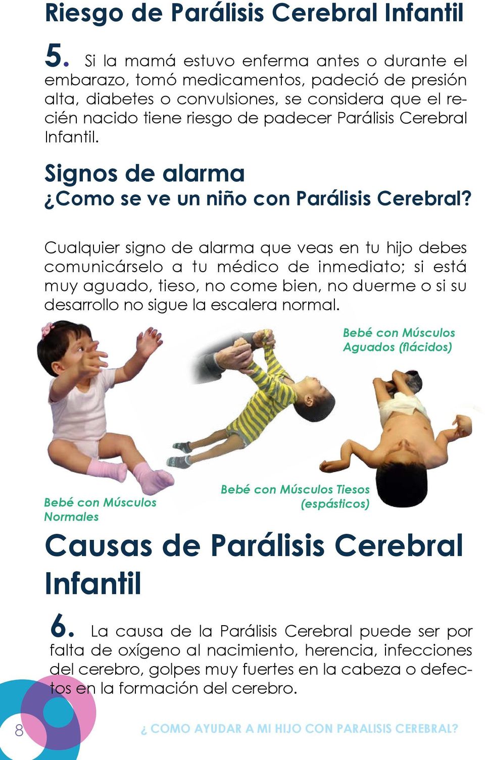 Cerebral Infantil. Signos de alarma Como se ve un niño con Parálisis Cerebral?