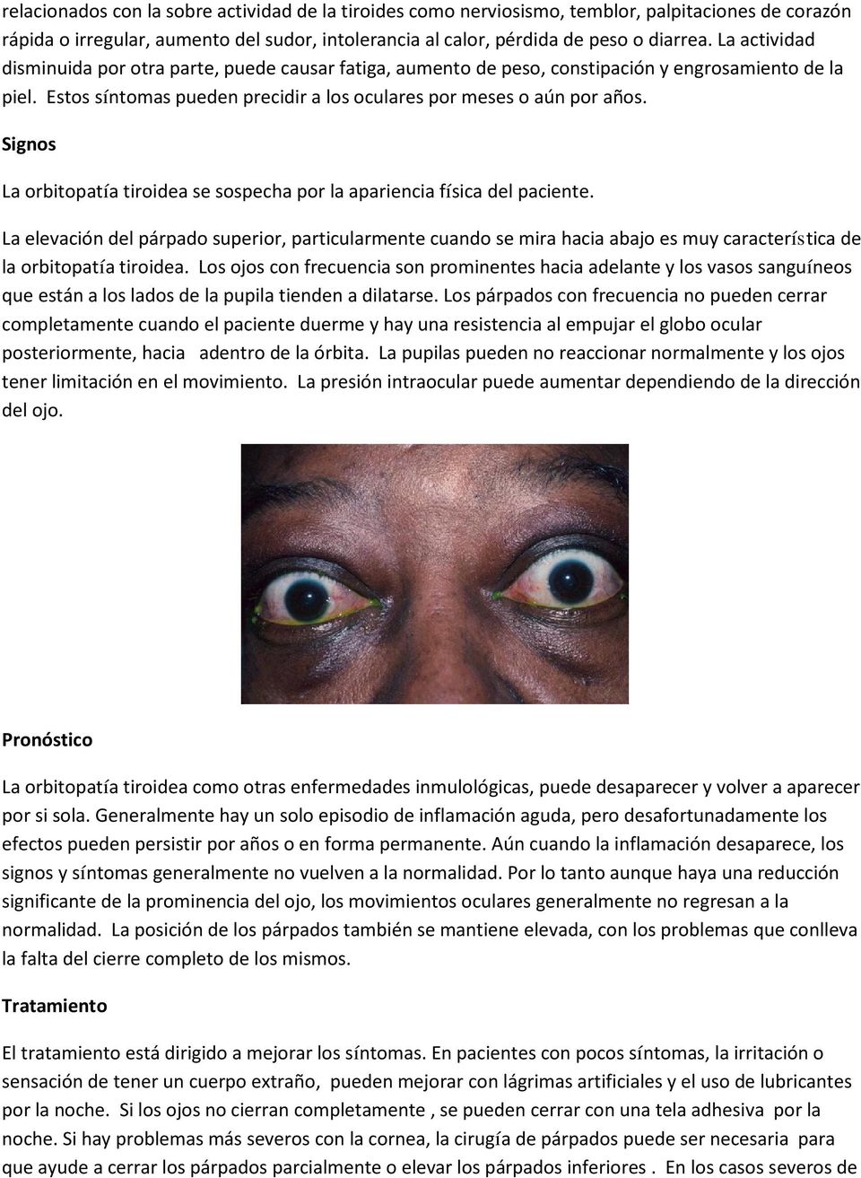 Signos La orbitopatía tiroidea se sospecha por la apariencia física del paciente.