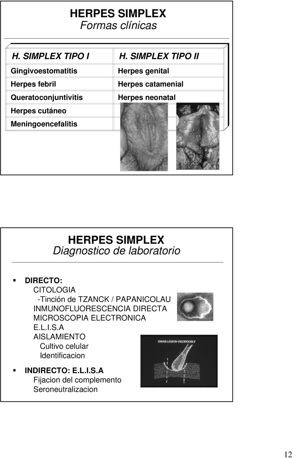 genital Herpes catamenial Herpes neonatal HERPES SIMPLEX Diagnostico de laboratorio DIRECTO: CITOLOGIA -Tinción de