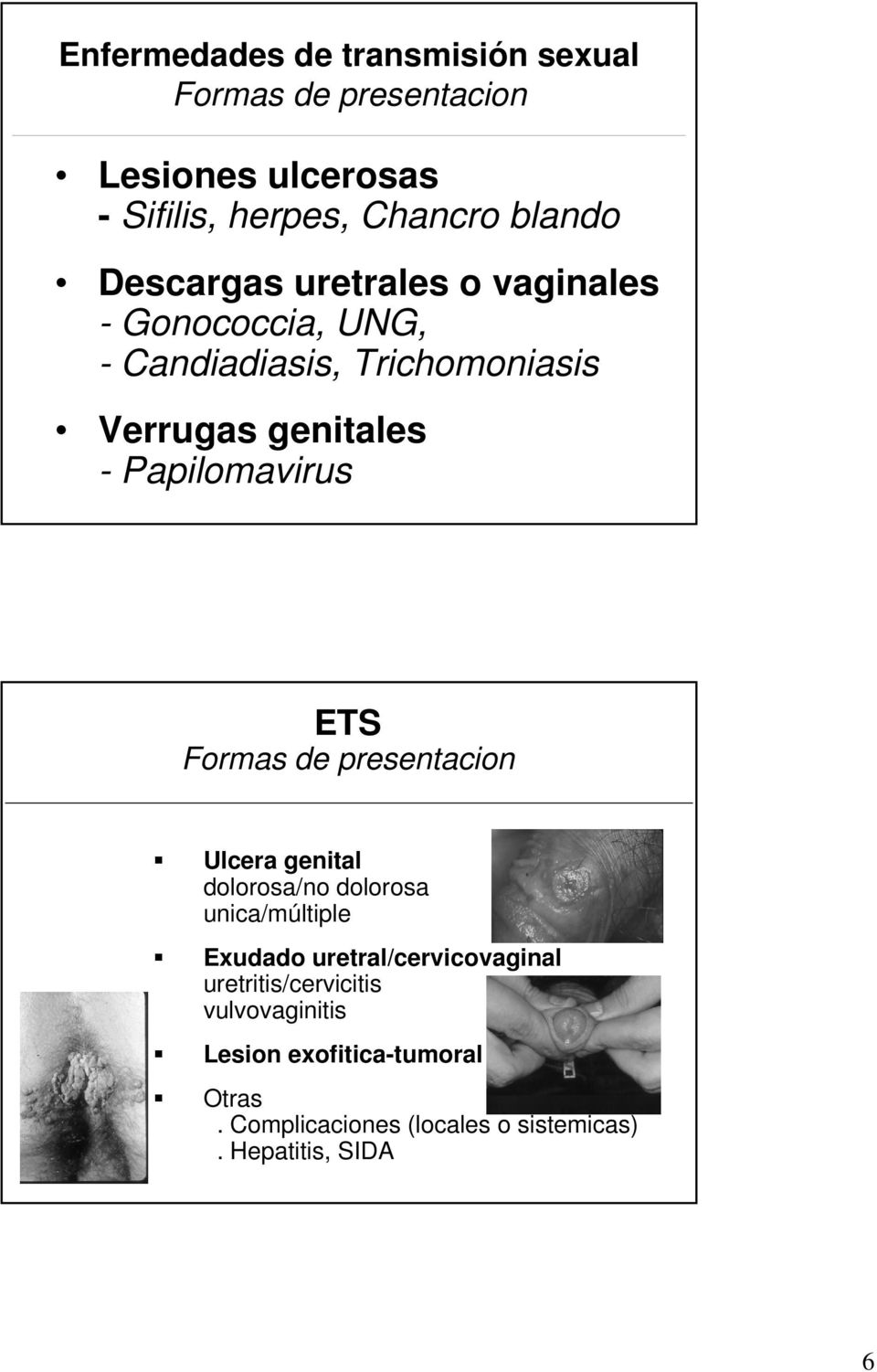 Papilomavirus ETS Formas de presentacion Ulcera genital dolorosa/no dolorosa unica/múltiple Exudado