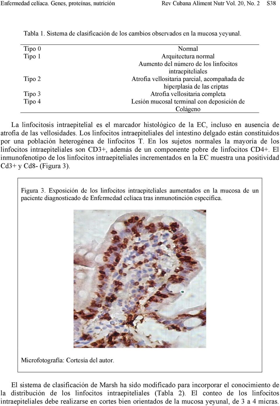 Lesión mucosal terminal con deposición de Colágeno La linfocitosis intraepitelial es el marcador histológico de la EC, incluso en ausencia de atrofia de las vellosidades.