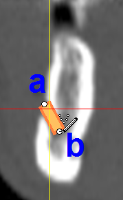 Haga clic en Añadir nervio para comenzar a dibujar el nervio en las vistas 2D (3).