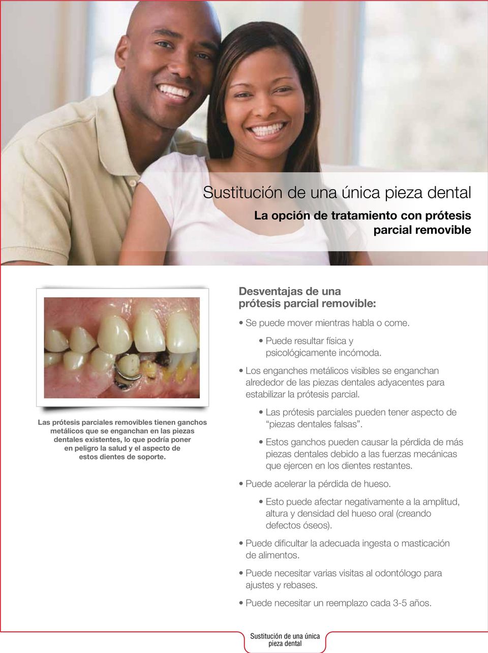 Las prótesis parciales removibles tienen ganchos metálicos que se enganchan en las piezas dentales existentes, lo que podría poner en peligro la salud y el aspecto de estos dientes de soporte.