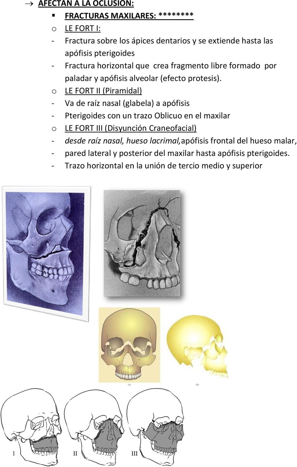 o LE FORT II (Piramidal) - Va de raíz nasal (glabela) a apófisis - Pterigoides con un trazo Oblicuo en el maxilar o LE FORT III (Disyunción