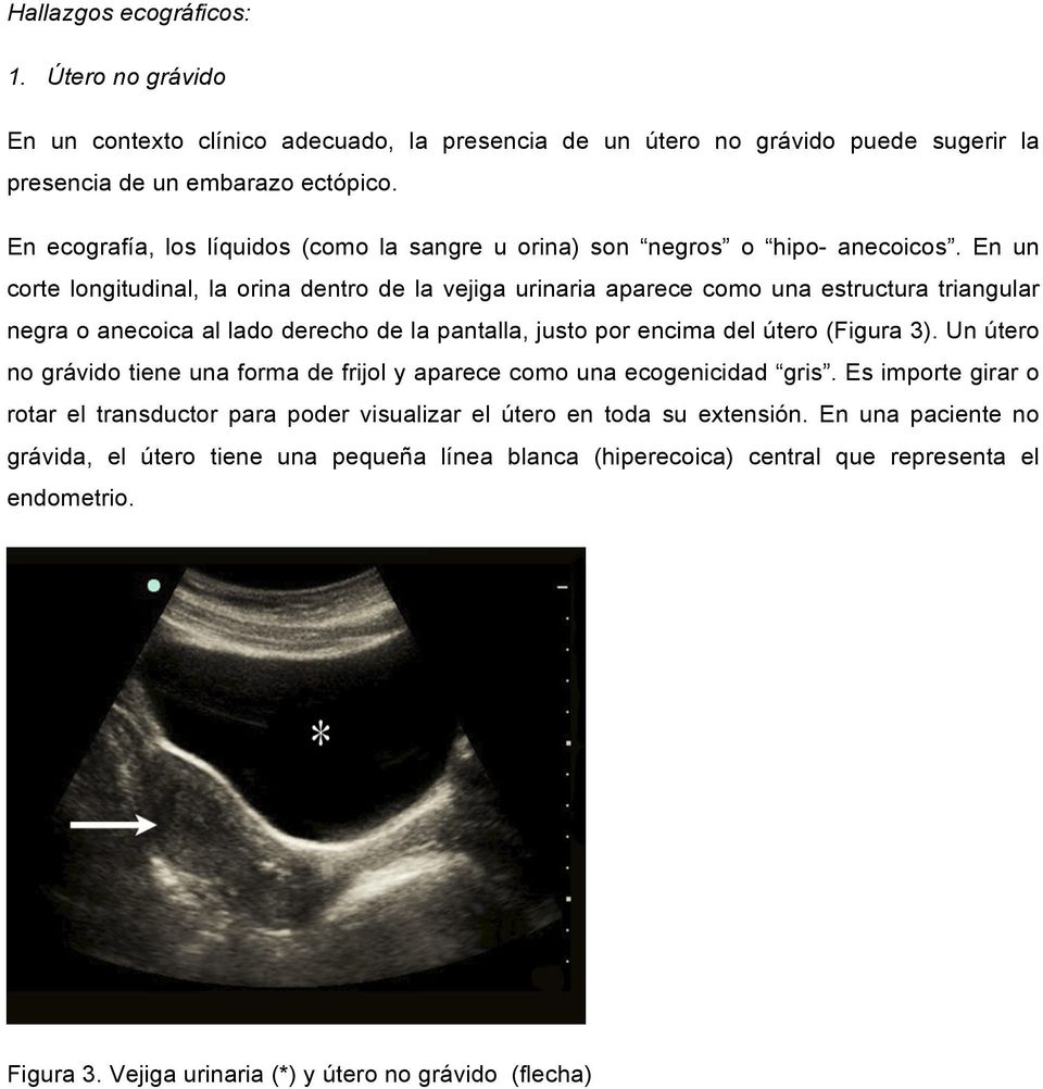 En un corte longitudinal, la orina dentro de la vejiga urinaria aparece como una estructura triangular negra o anecoica al lado derecho de la pantalla, justo por encima del útero (Figura 3).