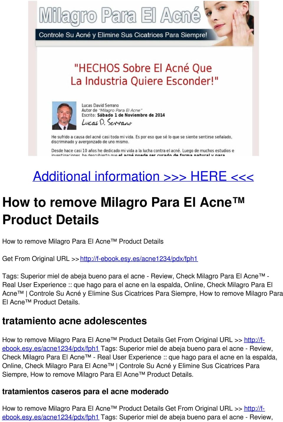 Acne Controle Su Acné y Elimine Sus Cicatrices Para Siempre, How to remove Milagro Para El Acne Product Details.