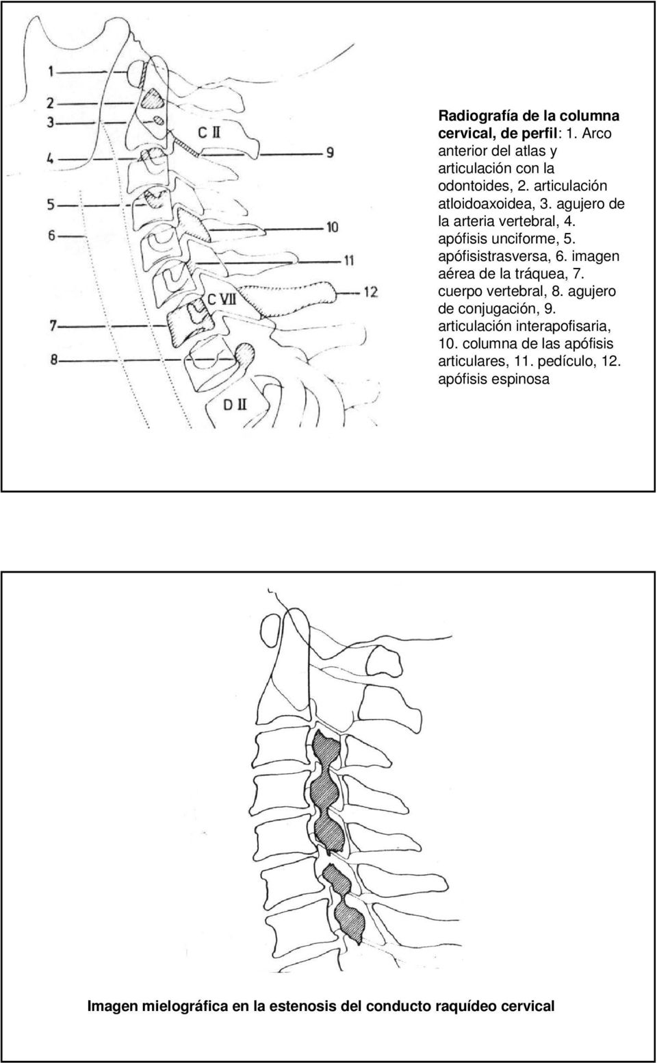 imagen aérea de la tráquea, 7. cuerpo vertebral, 8. agujero de conjugación, 9. articulación interapofisaria, 10.