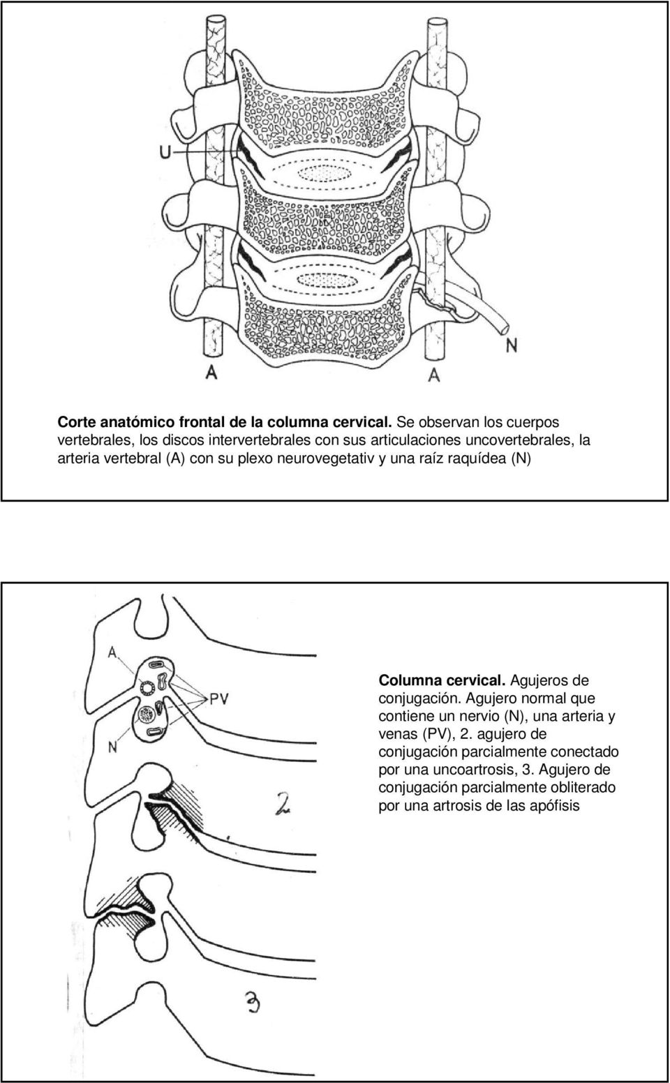 vertebral (A) con su plexo neurovegetativ y una raíz raquídea (N) Columna cervical. Agujeros de conjugación.