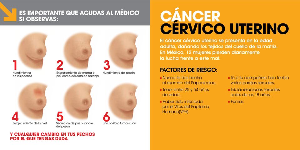 En México, 12 mujeres pierden diariamente la lucha frente a este mal. factores de riesgo: Nunca te has hecho el examen del Papanicolau. Tener entre 25 y 54 años de edad.
