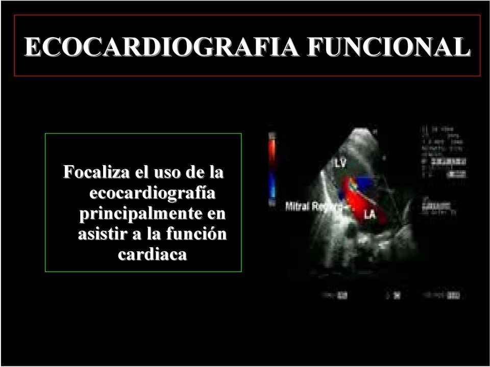 ecocardiografía