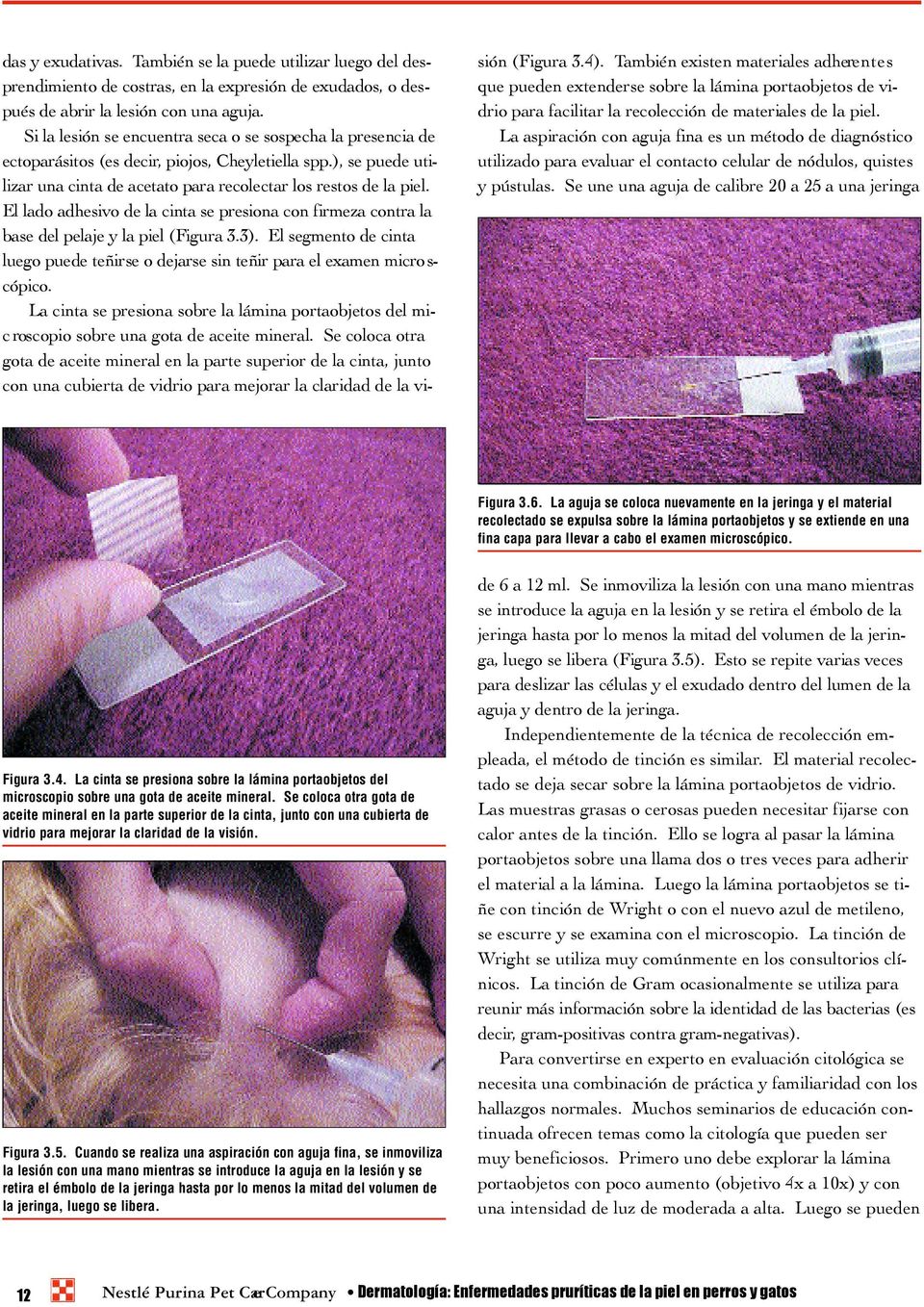 El lado adhesivo de la cinta se presiona con firmeza contra la base del pelaje y la piel (Figura 3.3). El segmento de cinta luego puede teñirse o dejarse sin teñir para el examen micro s- cópico.