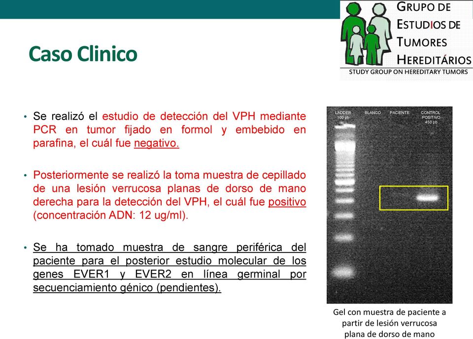 derecha para la detección del VPH, el cuál fue positivo (concentración ADN: 12 ug/ml).