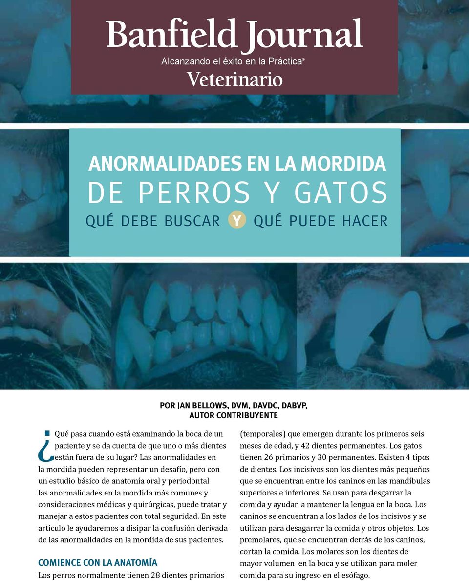 Las anormalidades en la mordida pueden representar un desafío, pero con un estudio básico de anatomía oral y periodontal las anormalidades en la mordida más comunes y consideraciones médicas y