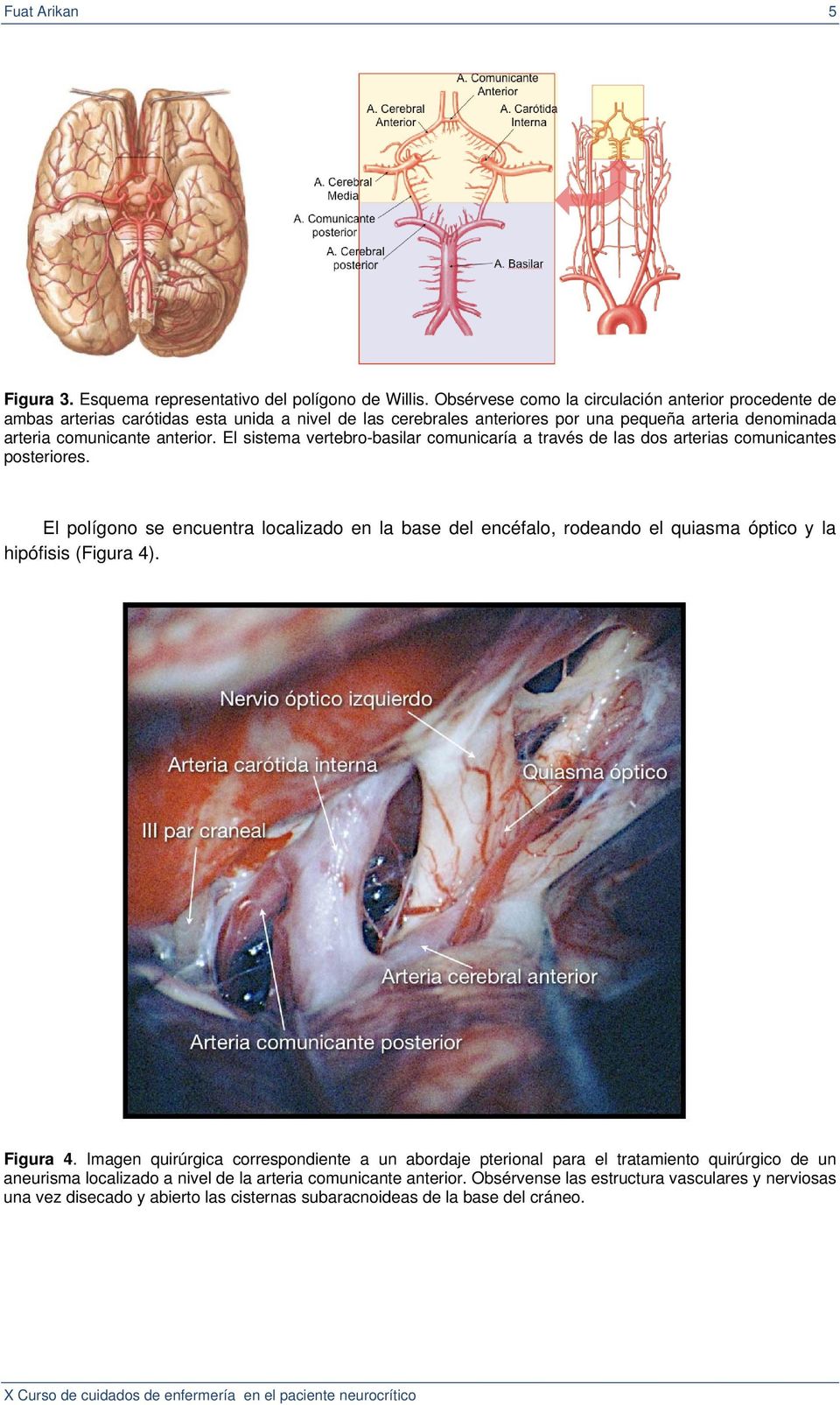 El sistema vertebro-basilar comunicaría a través de las dos arterias comunicantes posteriores.