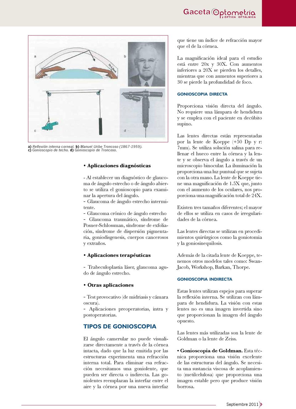 No requiere una lámpara de hendidura y se emplea con el paciente en decúbito supino. a) Reflexión interna corneal. b) Manuel Uribe Troncoso (1867-1959). c) Gonioscopio de techo.