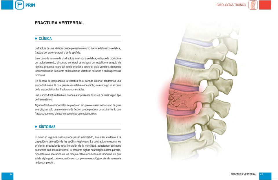 anterior o posterior de la vértebra, siendo su localización más frecuente en las últimas vértebras dorsales o en las primeras lumbares.