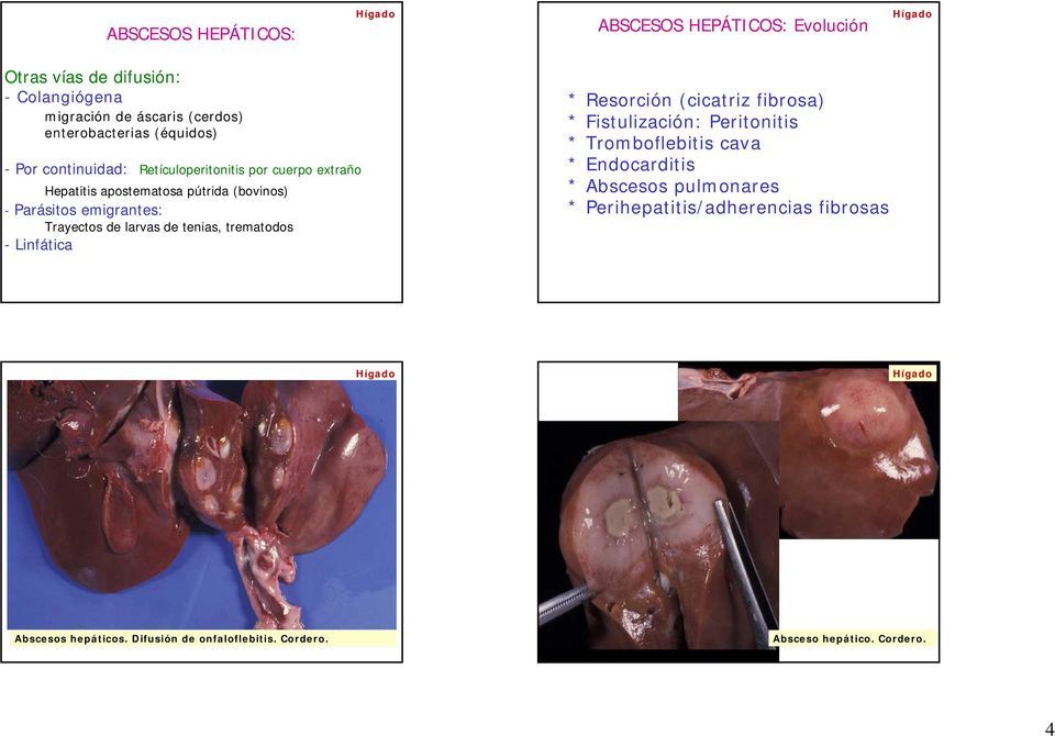 Trayectos de larvas de tenias, trematodos - Linfática * Resorción (cicatriz fibrosa) * Fistulización: Peritonitis * Tromboflebitis cava *