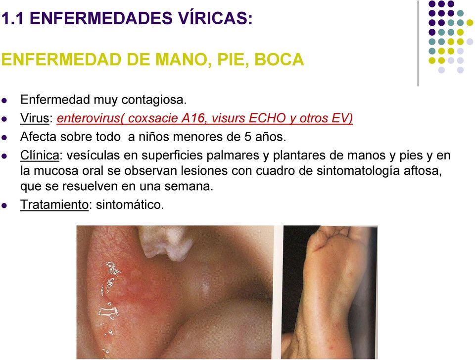 años. Clínica: vesículas en superficies palmares y plantares de manos y pies y en la mucosa oral