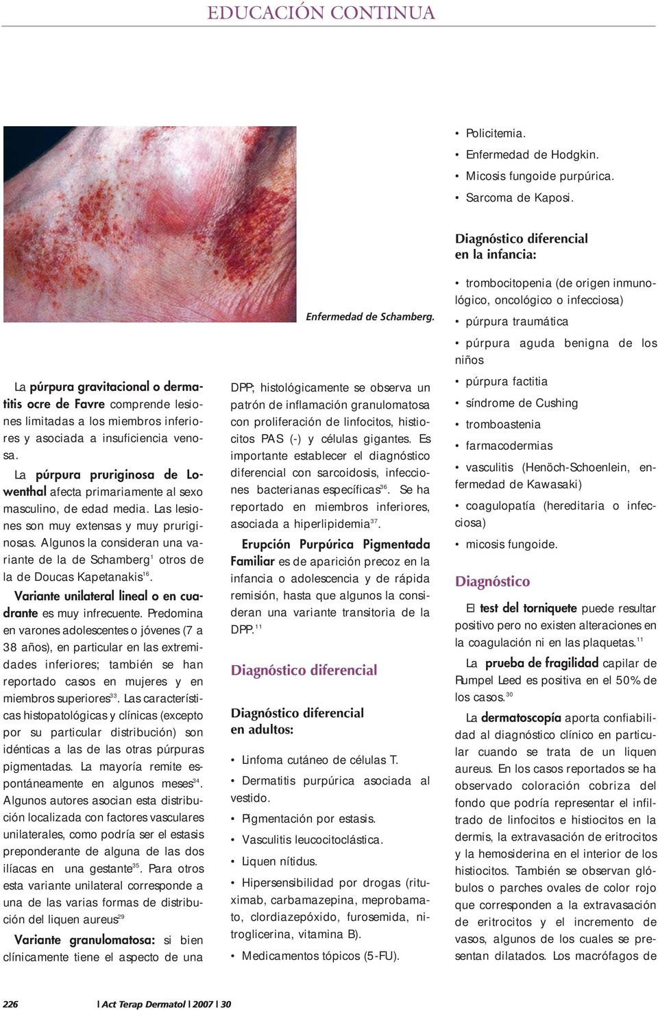 La púrpura pruriginosa de Lowenthal afecta primariamente al sexo masculino, de edad media. Las lesiones son muy extensas y muy pruriginosas.