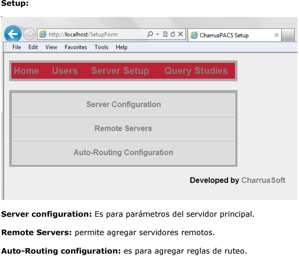 Remote Servers: permite agregar servidores