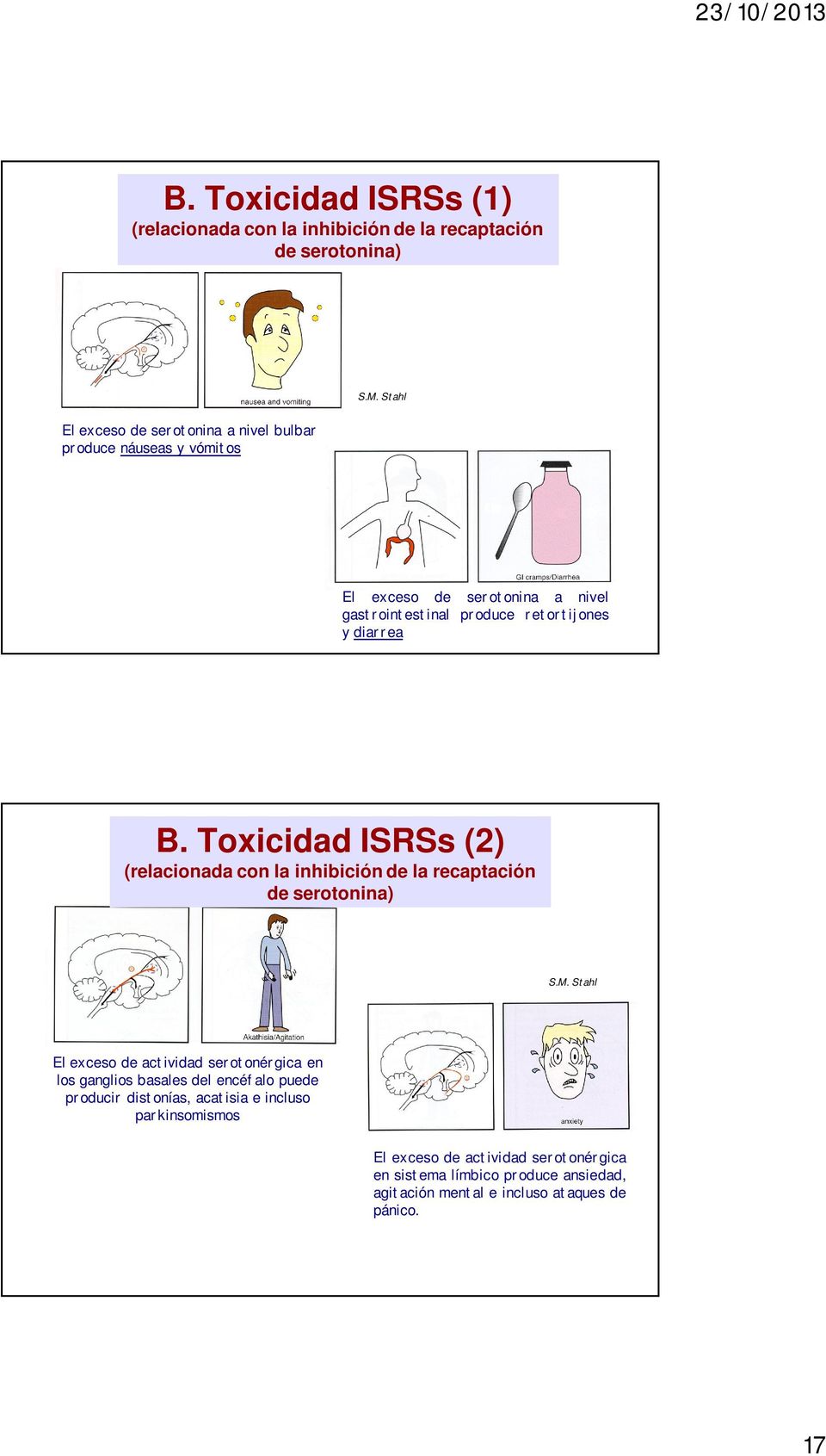 B. Toxicidad ISRSs (2) (relacionada con la inhibición de la recaptación de serotonina) S.M.