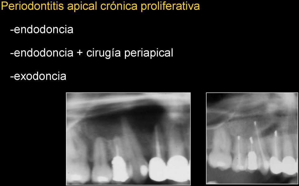 -endodoncia -endodoncia