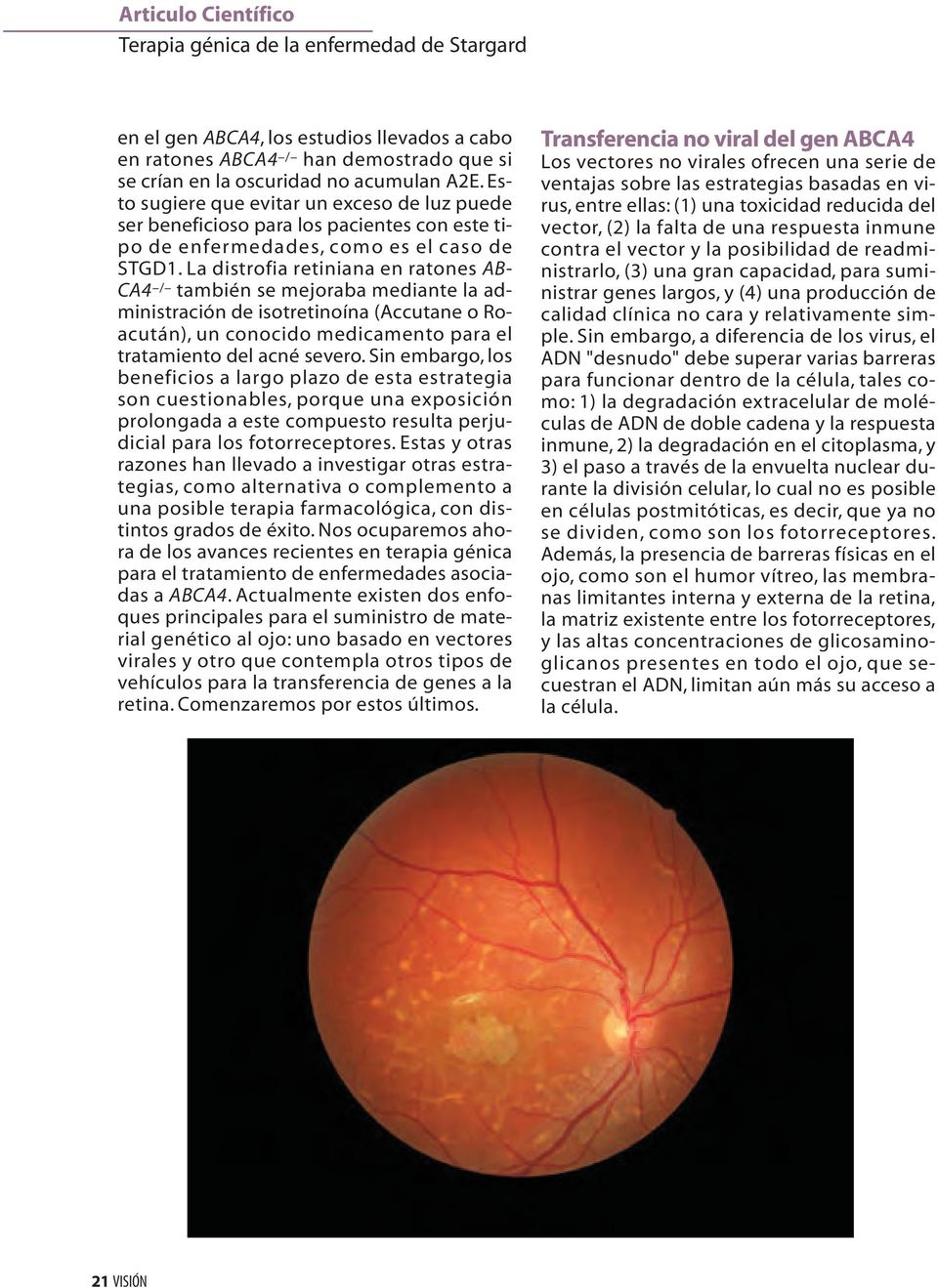 La distrofia retiniana en ratones AB- CA4 / también se mejoraba mediante la administración de isotretinoína (Accutane o Roacután), un conocido medicamento para el tratamiento del acné severo.