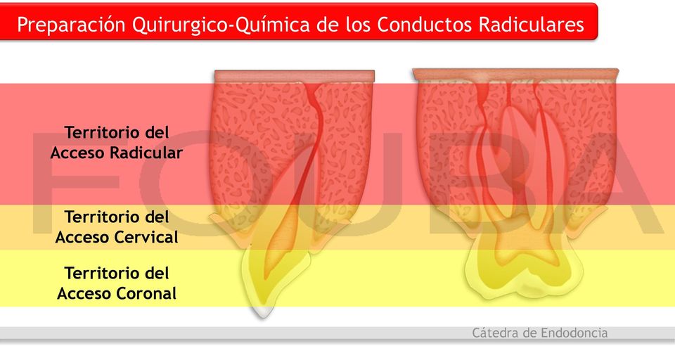 Radicular Territorio del Acceso Cervical