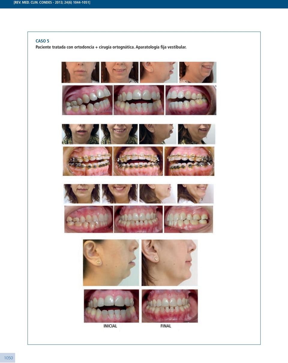 5 Paciente tratada con ortodoncia +