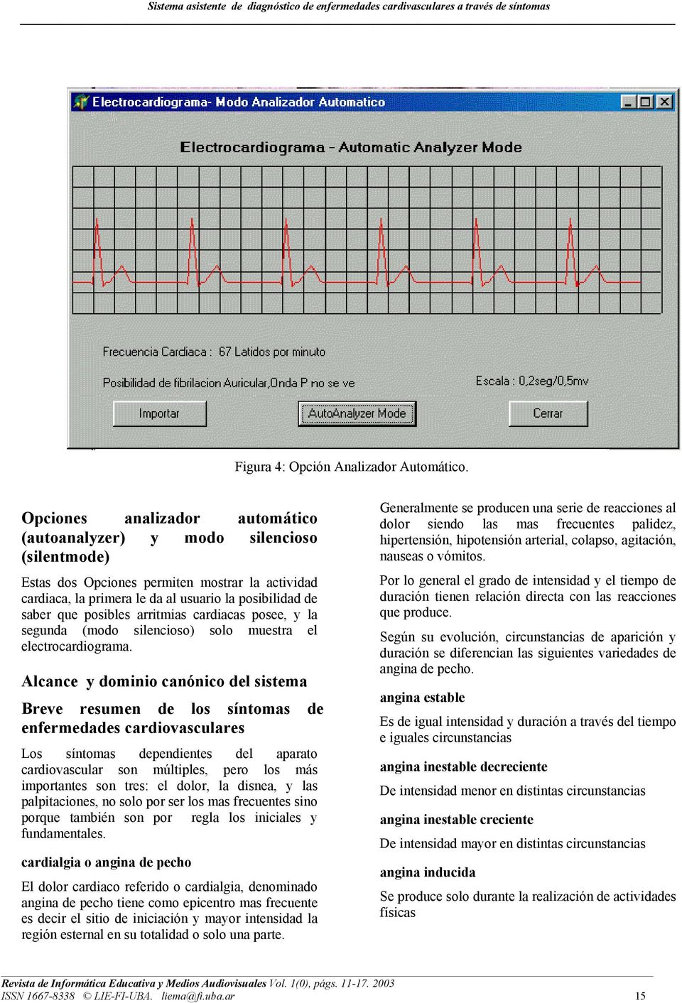 posibles arritmias cardiacas posee, y la segunda (modo silencioso) solo muestra el electrocardiograma.
