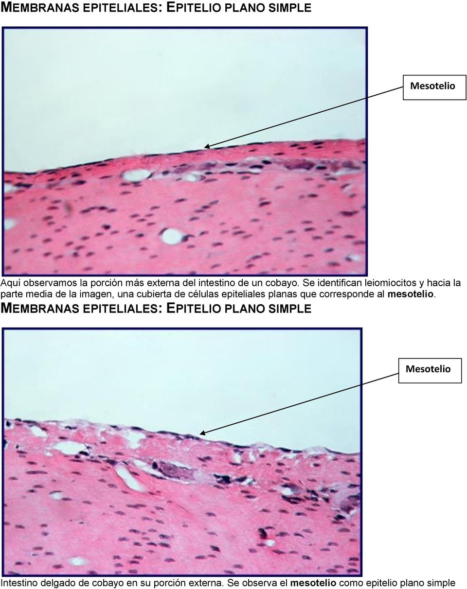 Se identifican leiomiocitos y hacia la parte media de la imagen, una cubierta de células epiteliales