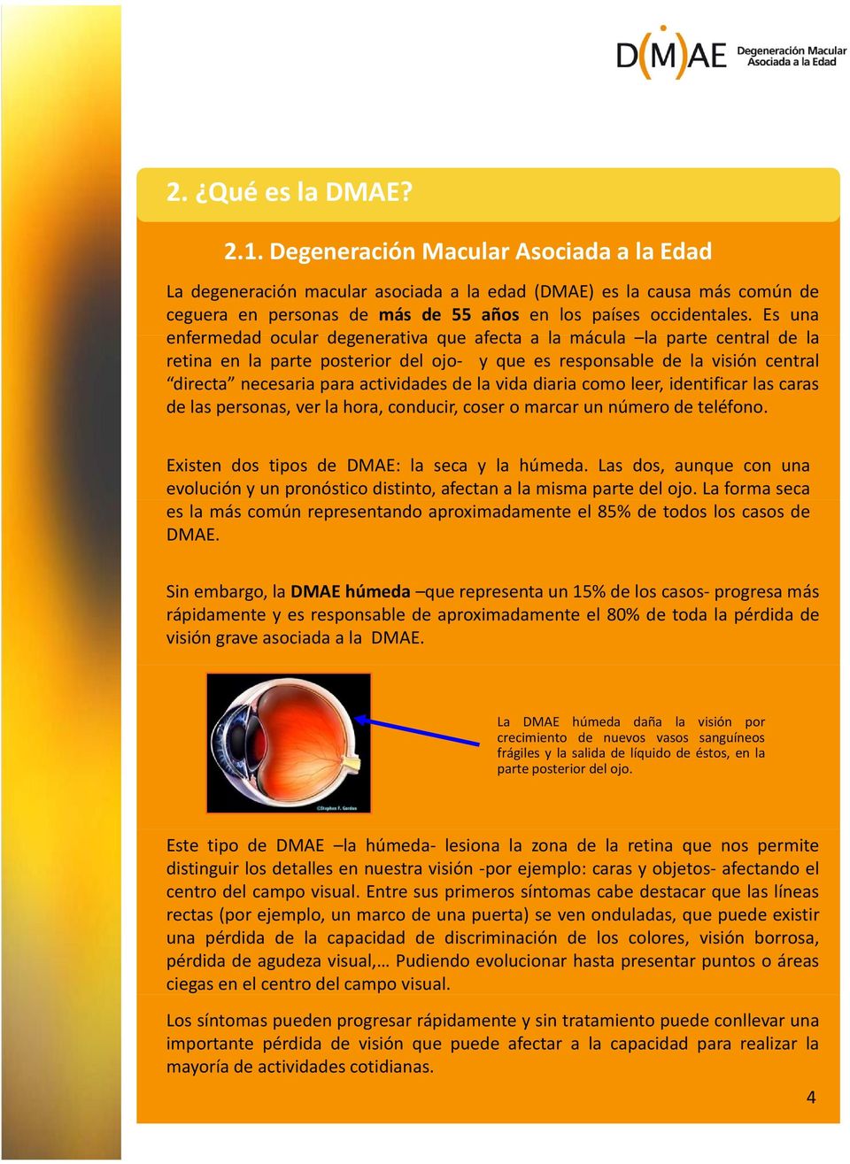 Es una enfermedad ocular degenerativa que afecta a la mácula la parte central de la retina en la parte posterior del ojo yqueesresponsabledelavisióncentral directa necesaria para actividades de la