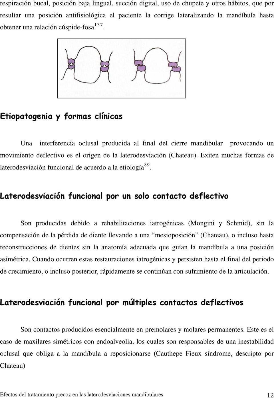 Etiopatogenia y formas clínicas Una interferencia oclusal producida al final del cierre mandibular provocando un movimiento deflectivo es el origen de la laterodesviación (Chateau).