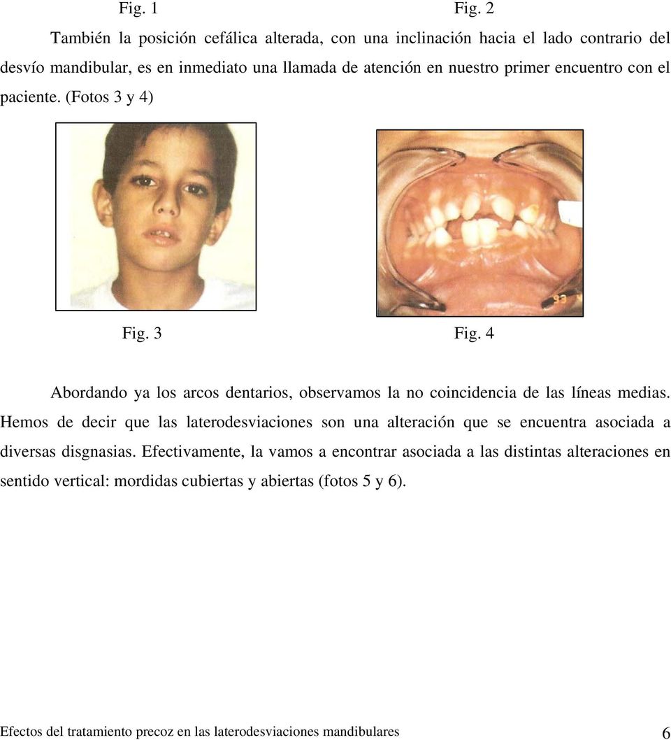 primer encuentro con el paciente. (Fotos 3 y 4) Fig. 3 Fig. 4 Abordando ya los arcos dentarios, observamos la no coincidencia de las líneas medias.