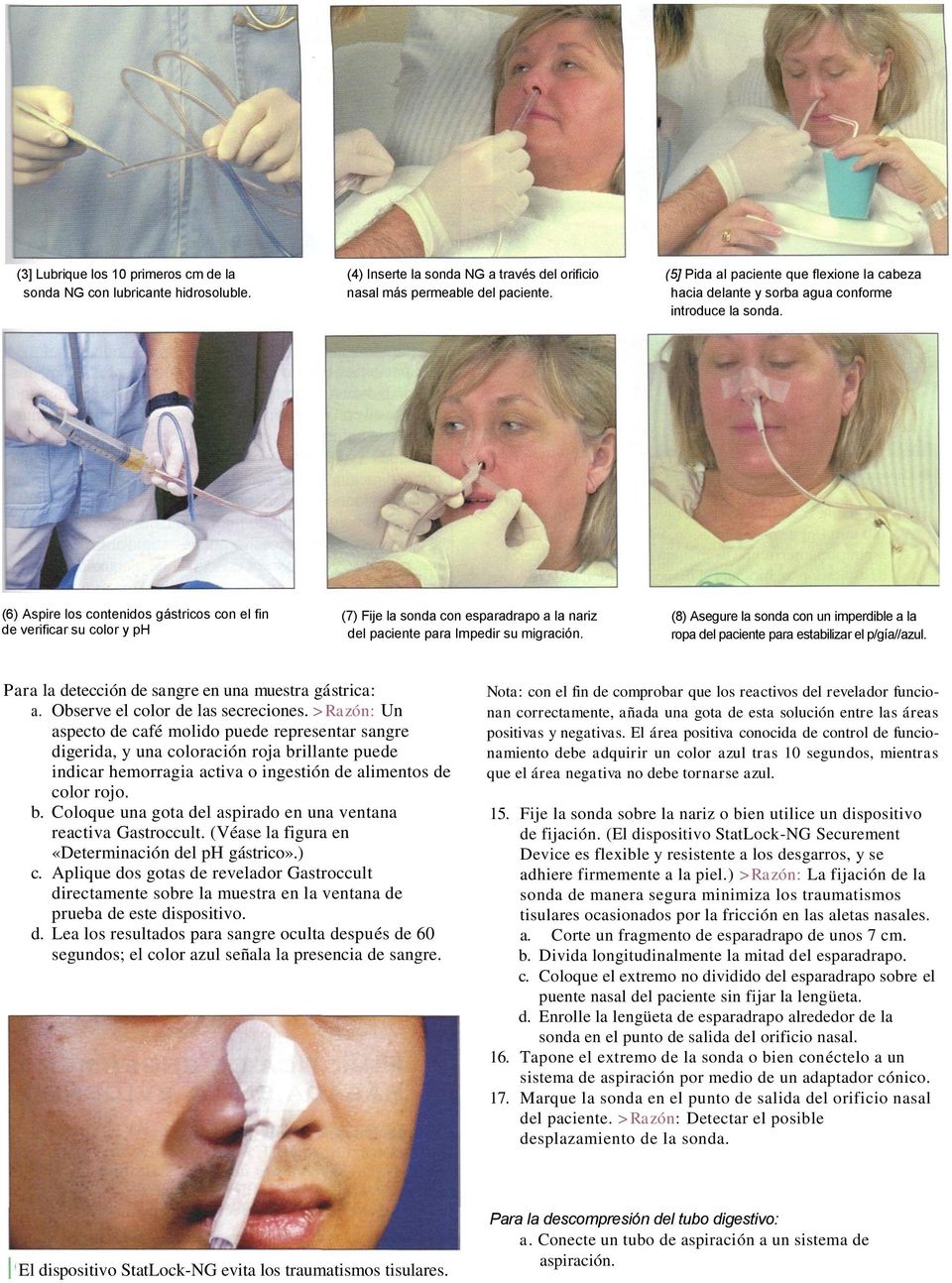 (6) Aspire los contenidos gástricos con el fin de verificar su color y ph (7) Fije la sonda con esparadrapo a la nariz del paciente para Impedir su migración.
