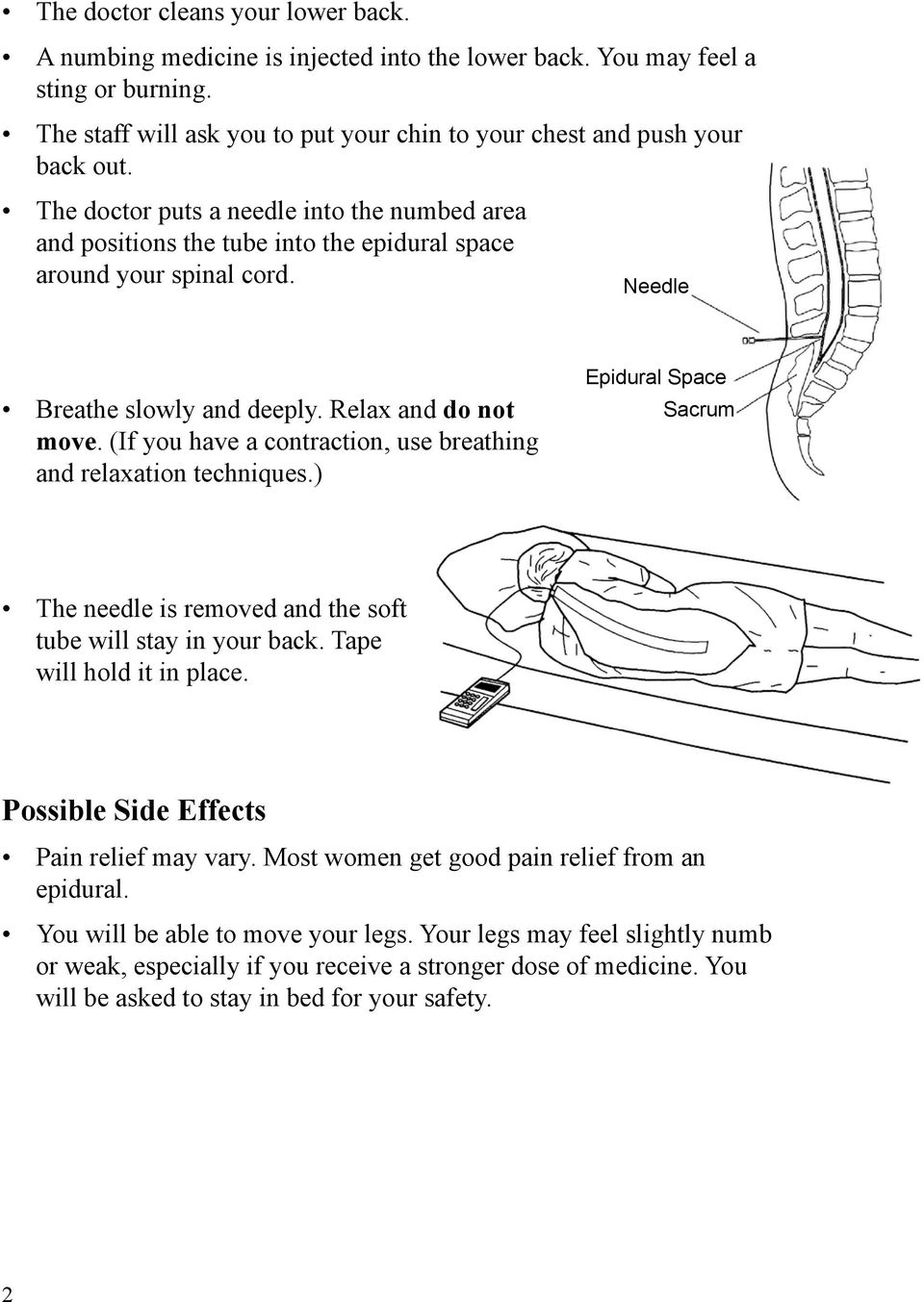(If you have a contraction, use breathing and relaxation techniques.) Epidural Space Sacrum The needle is removed and the soft tube will stay in your back. Tape will hold it in place.