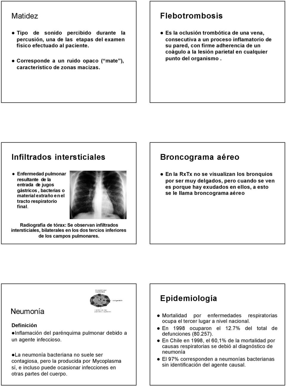 Infiltrados intersticiales Broncograma aéreo Enfermedad pulmonar resultante de la entrada de jugos gástricos, bacterias o material extraño enel tracto respiratorio final.