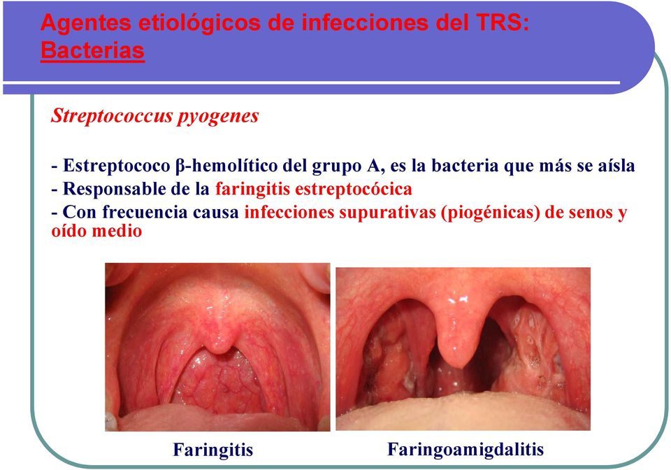 Responsable de la faringitis estreptocócica - Con frecuencia causa