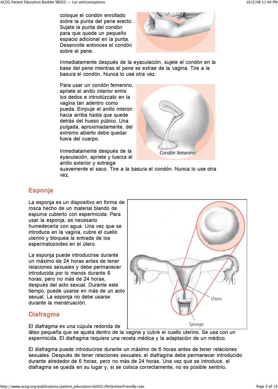 Para usar un condón femenino, apriete el anillo interior entre los dedos e introdúzcalo en la vagina tan adentro como pueda.