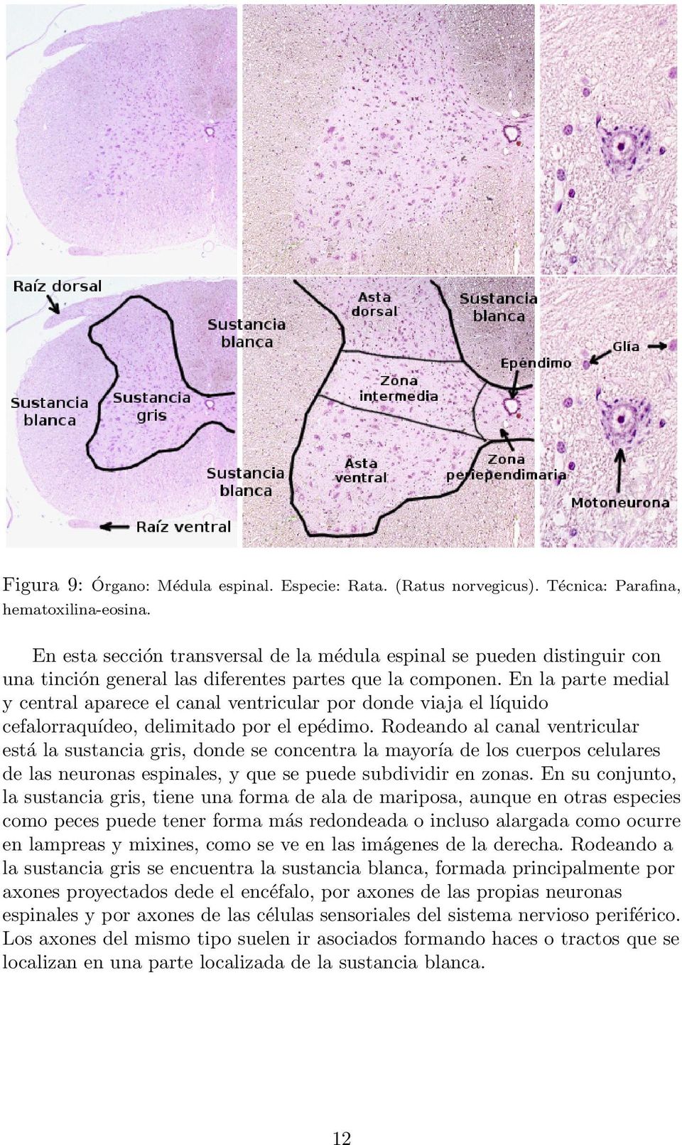 En la parte medial y central aparece el canal ventricular por donde viaja el líquido cefalorraquídeo, delimitado por el epédimo.