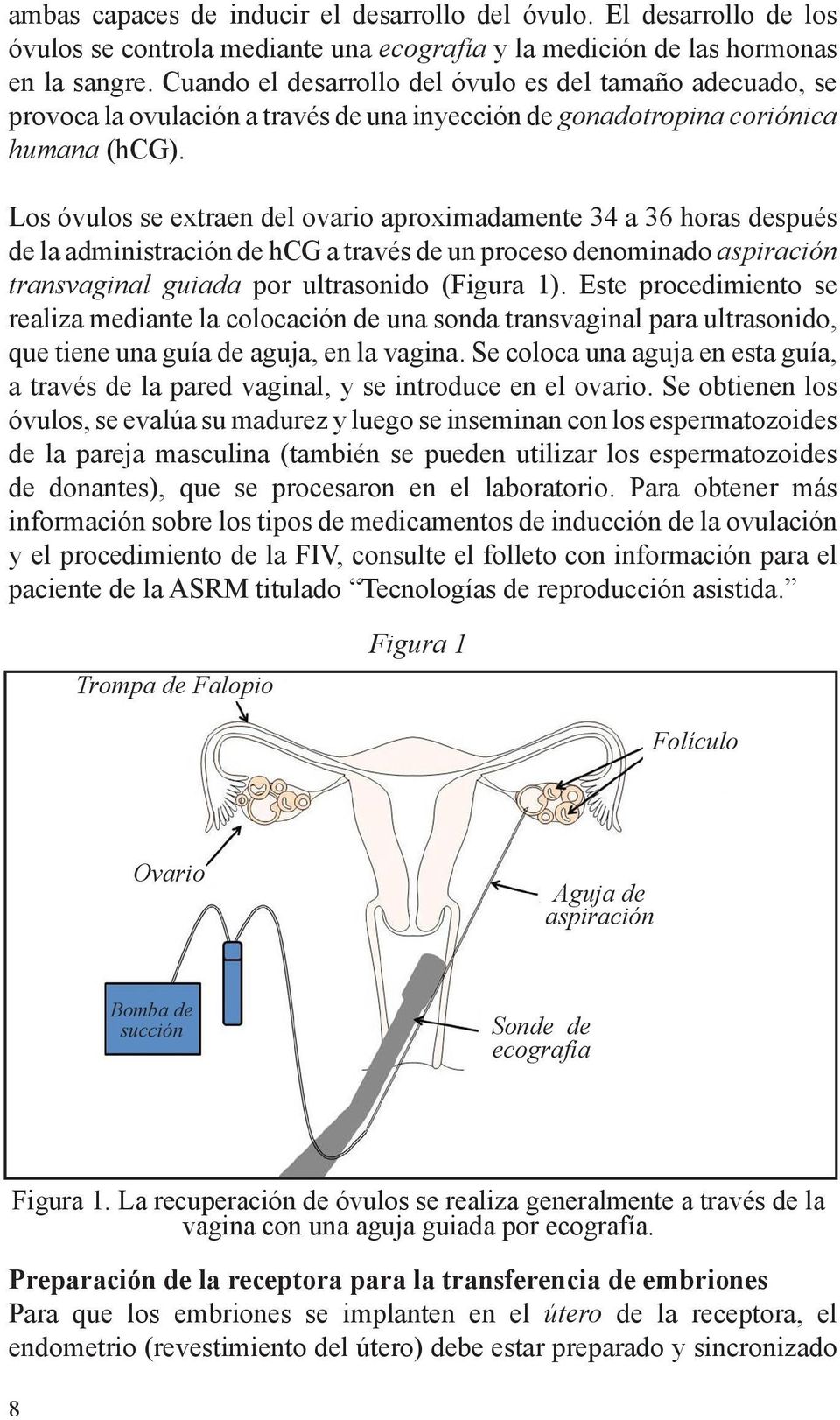 Los óvulos se extraen del ovario aproximadamente 34 a 36 horas después de la administración de hcg a través de un proceso denominado aspiración transvaginal guiada por ultrasonido (Figura 1).