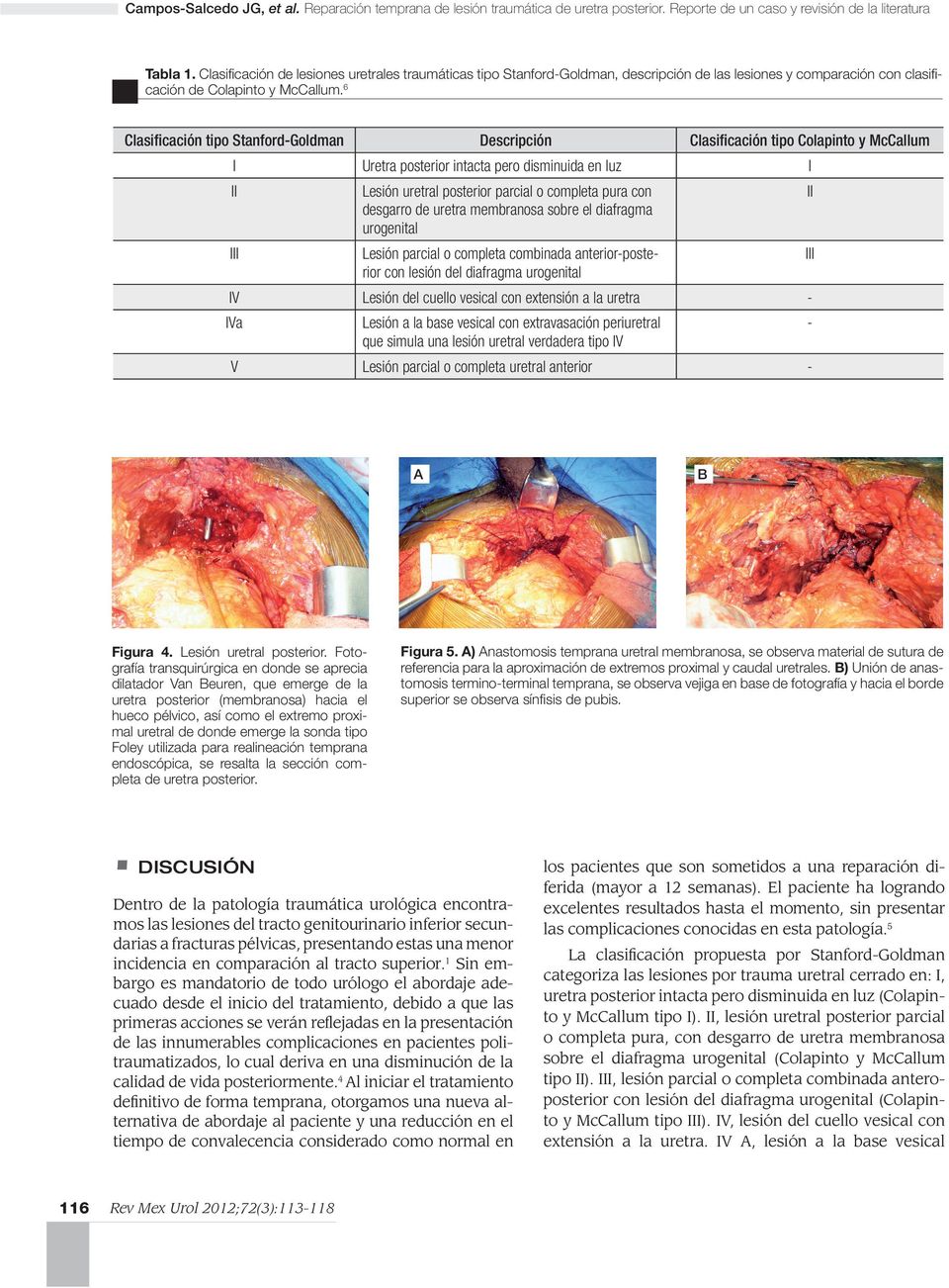 Clasificación de lesiones uretrales traumáticas tipo Stanford-Goldman, descripción de las lesiones y comparación con clasificación de Colapinto y McCallum.