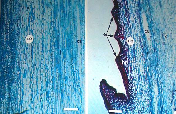 Estudios histopatológicos Noriega (1996), observó abundantes depósitos de fenoles en epidermis y corteza,