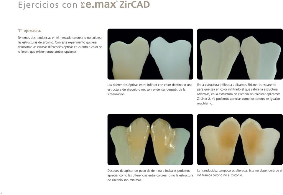 Las diferencias ópticas entre infiltrar con color dentinario una estructura de zirconio o no, son evidentes después de la sinterización.