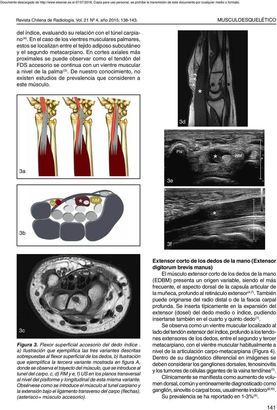 En cortes axiales más proximales se puede observar como el tendón del FDS accesorio se continua con un vientre muscular a nivel de la palma (3).